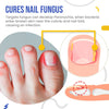 Load image into Gallery viewer, NailSpeed™ Light Cure Fungal Nail Pen