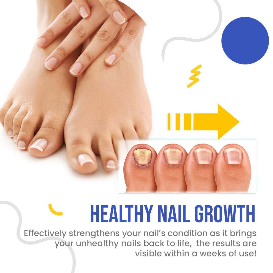 NailSpeed™ Light Cure Fungal Nail Pen