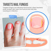 Load image into Gallery viewer, FungusShield Nail Treatment Cream