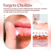 Load image into Gallery viewer, Cold Sores Lip Cheilitis Treatment Cream