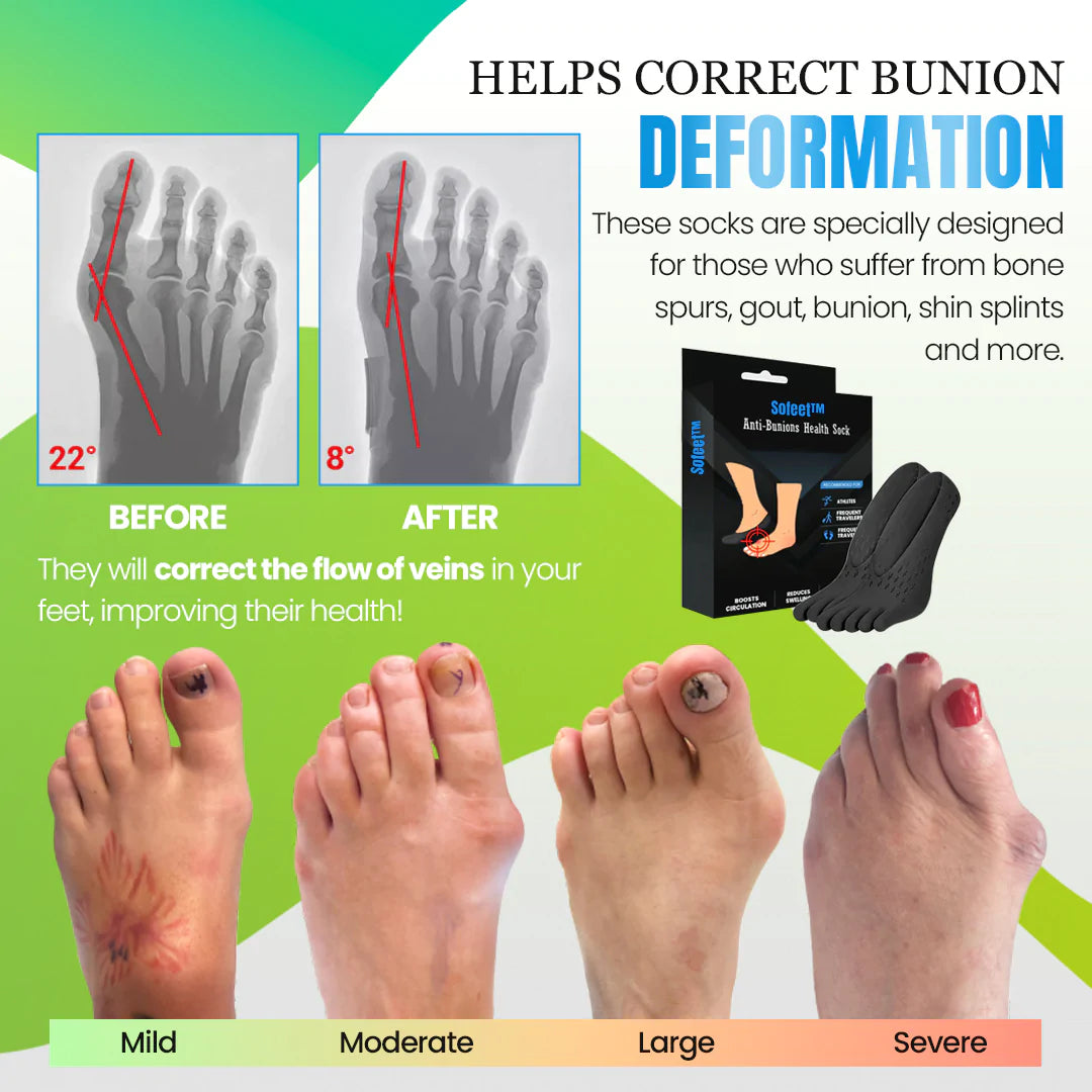 Sofeet™ Bunion Cure Health Sock