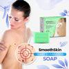 Load image into Gallery viewer, SmoothSkin Wart Eliminator Soap