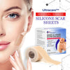 Load image into Gallery viewer, Ultracare™Medical Grade Silicone Scar Sheets